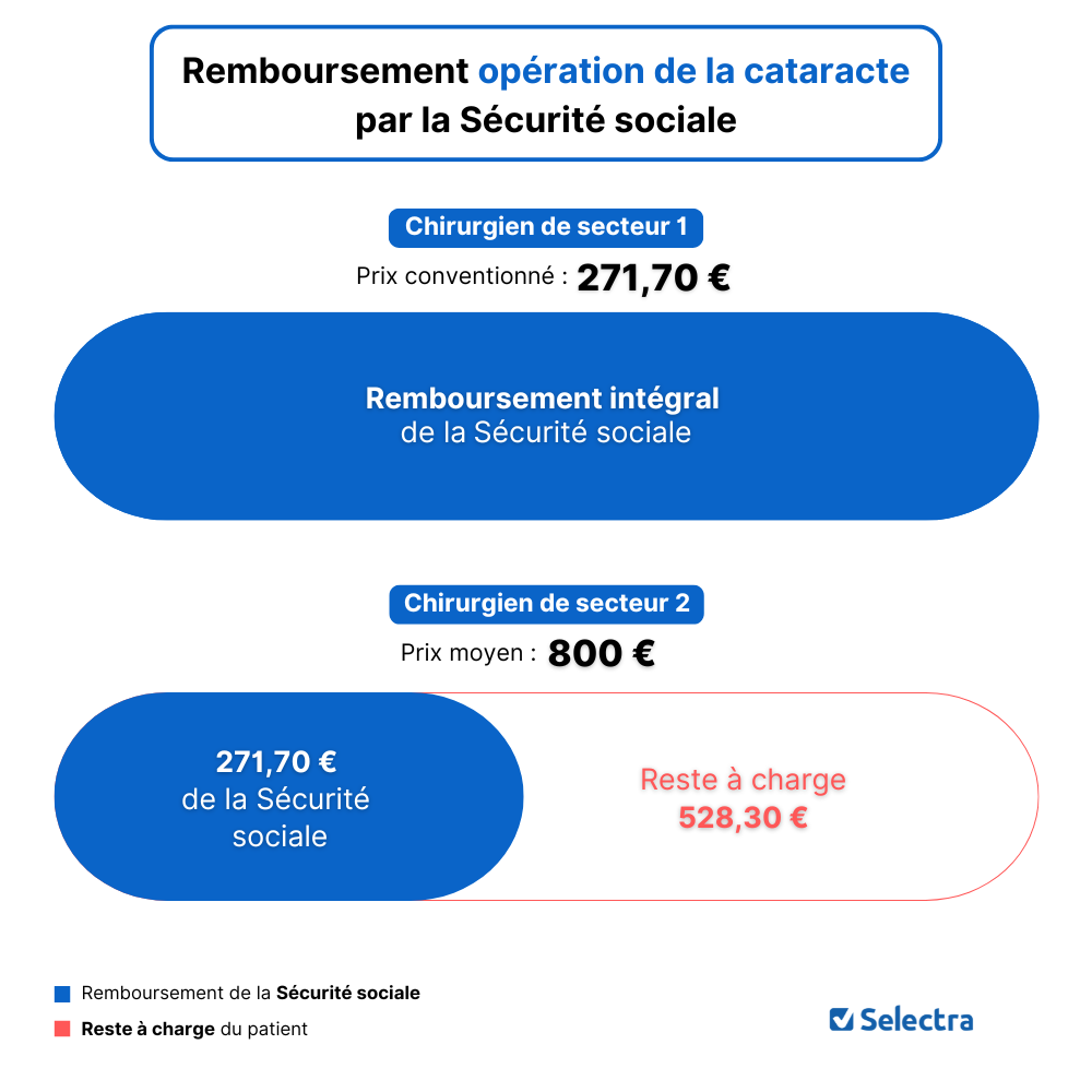 Remboursement opération de la cataracte