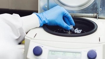 Covid-19 : bientôt un test rapide ambulatoire et connecté pour aider au dépistage massif ?